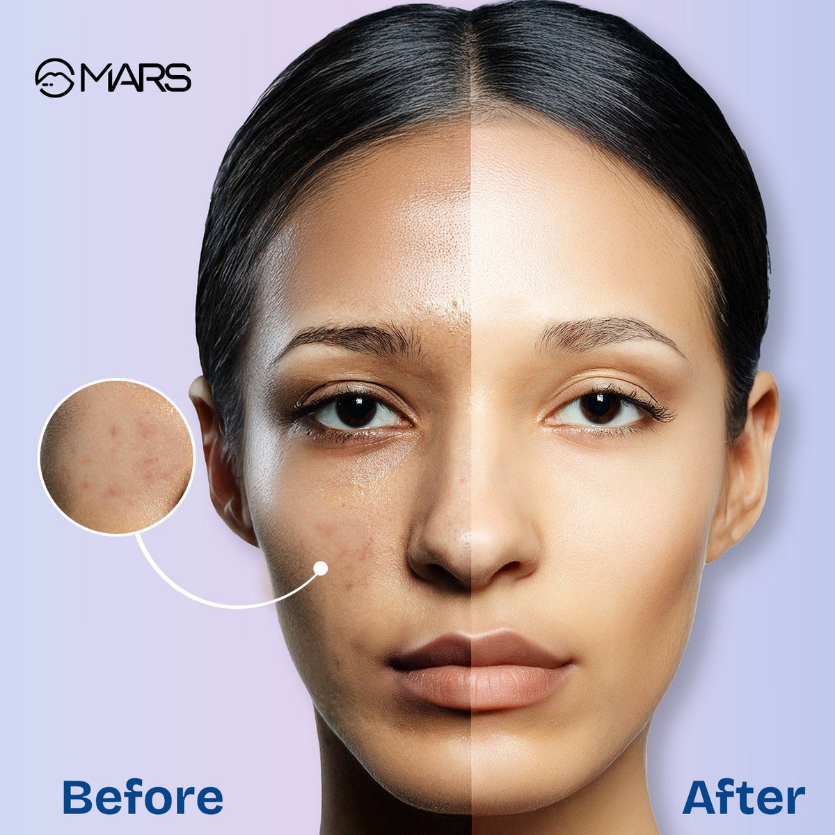 MARS Setter and Blotter Gel Compact for Poreless Effect ( 5gm) with Applicator | Oil Control | Mattifying Formula | Long-Last