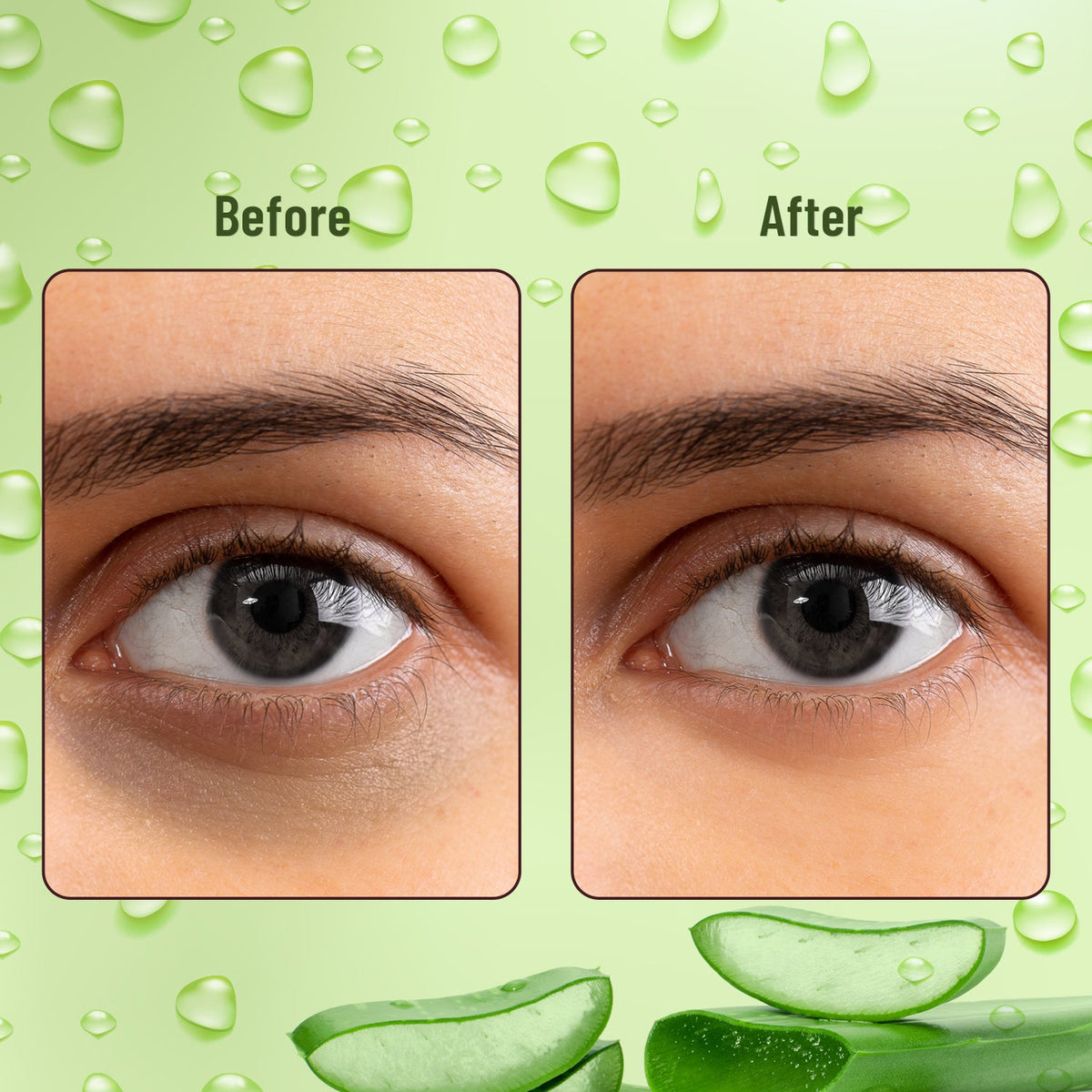 Hydra Eye Serum Patch with Aloe Vera